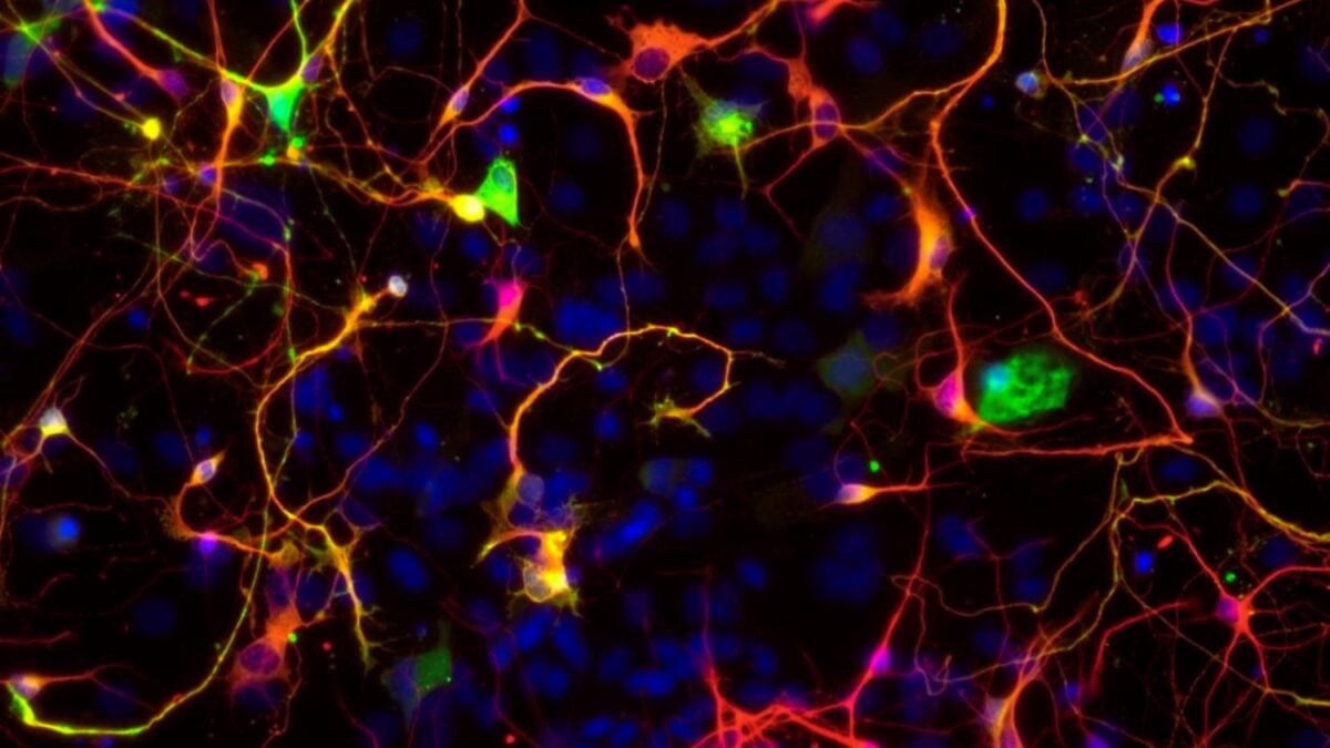 Las células olvidadas del cerebro estaban engañándonos. Un experimento permitió ver a los astrocitos en su forma real por primera vez y podría cambiar la investigación neurológica