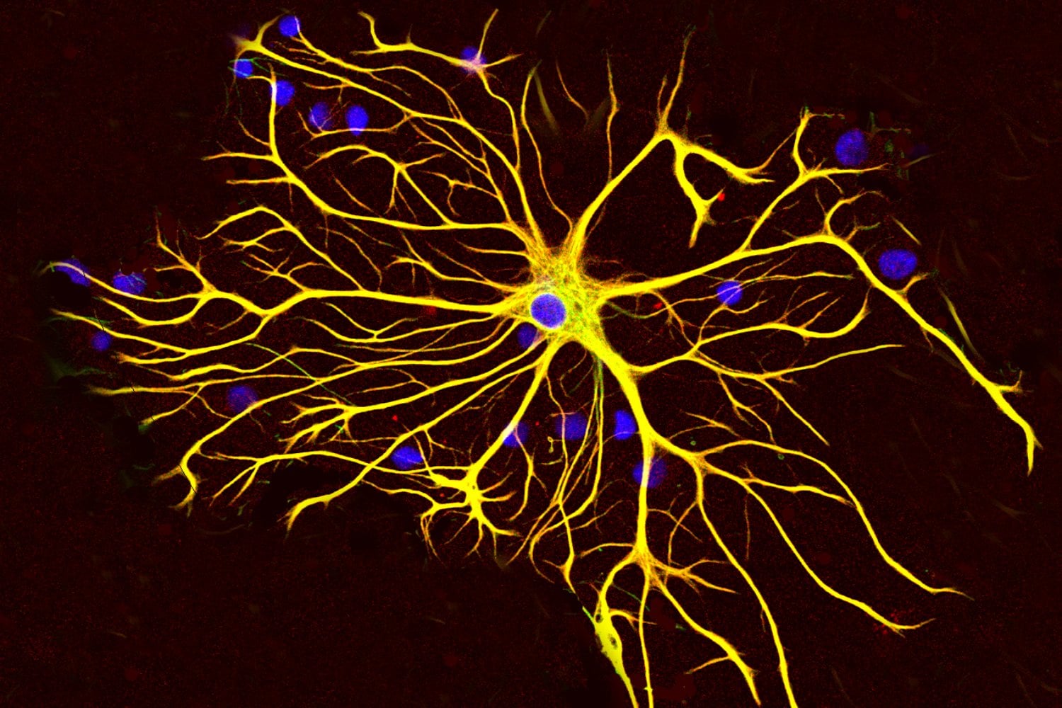 Las células olvidadas del cerebro estaban engañándonos. Un experimento permitió ver a los astrocitos en su forma real por primera vez y podría cambiar la investigación neurológica