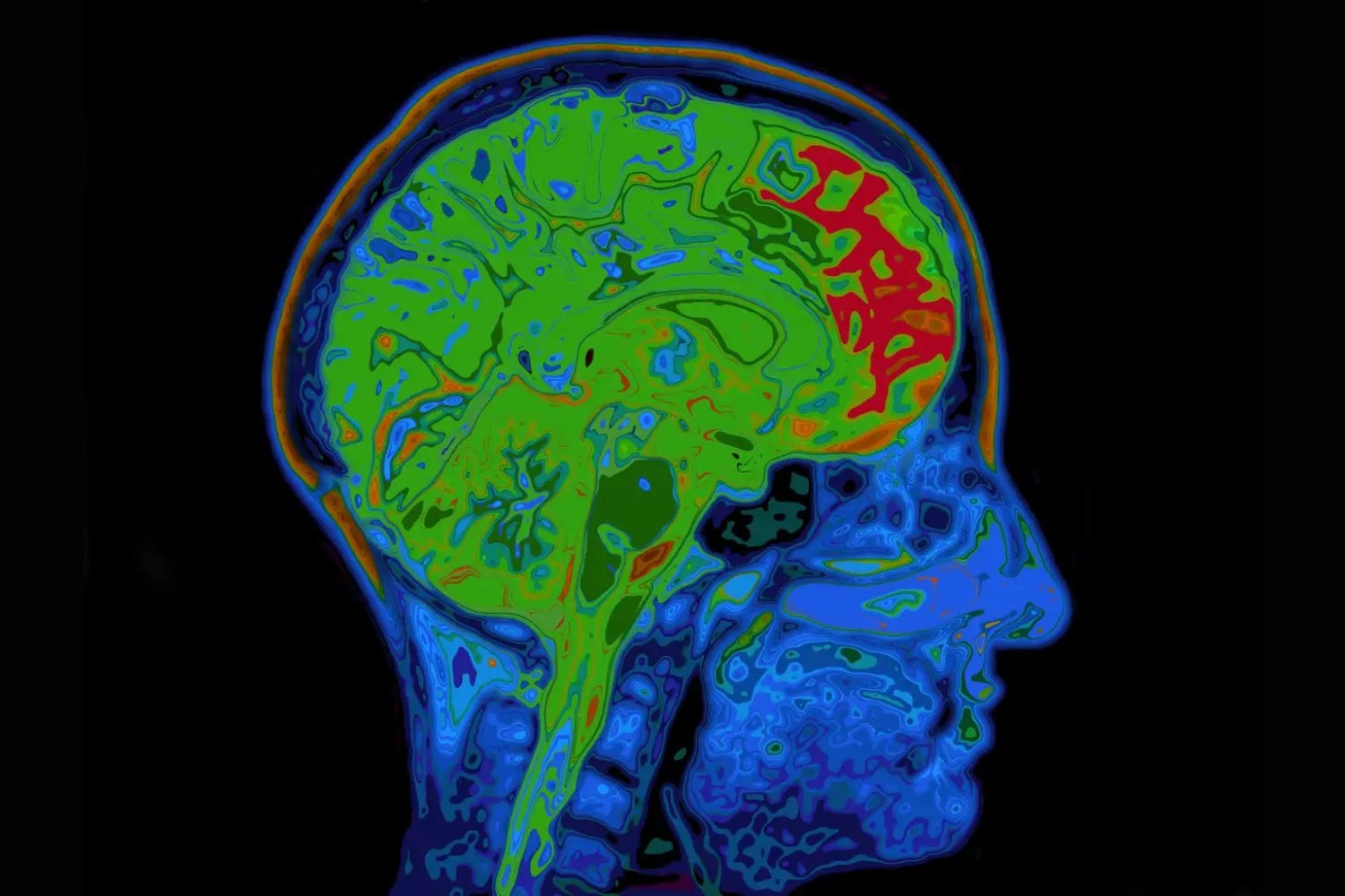 Por qué el cerebro aprende tan rápido lo que le hace daño. El interruptor oculto que acelera la formación de hábitos