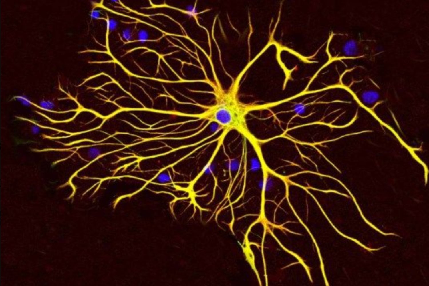 Retrato de un astrocito: así lograron ver la verdadera forma de una de las células más misteriosas del cerebro