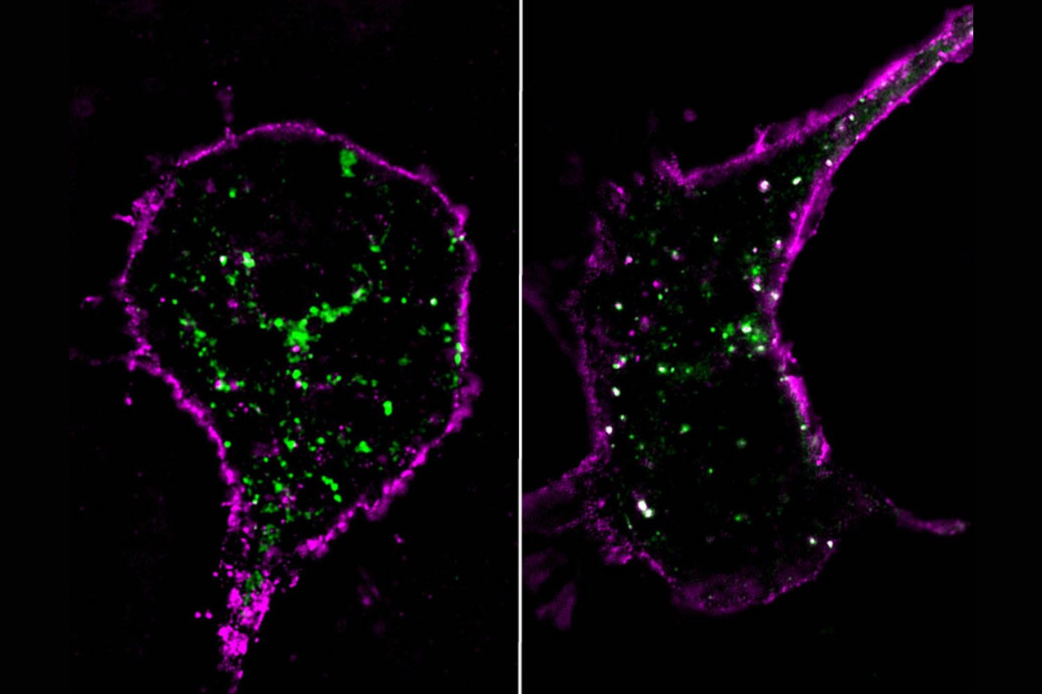 La proteína silenciosa del cerebro que decide cuánta hambre sentimos (y por qué no todas las dietas funcionan igual)