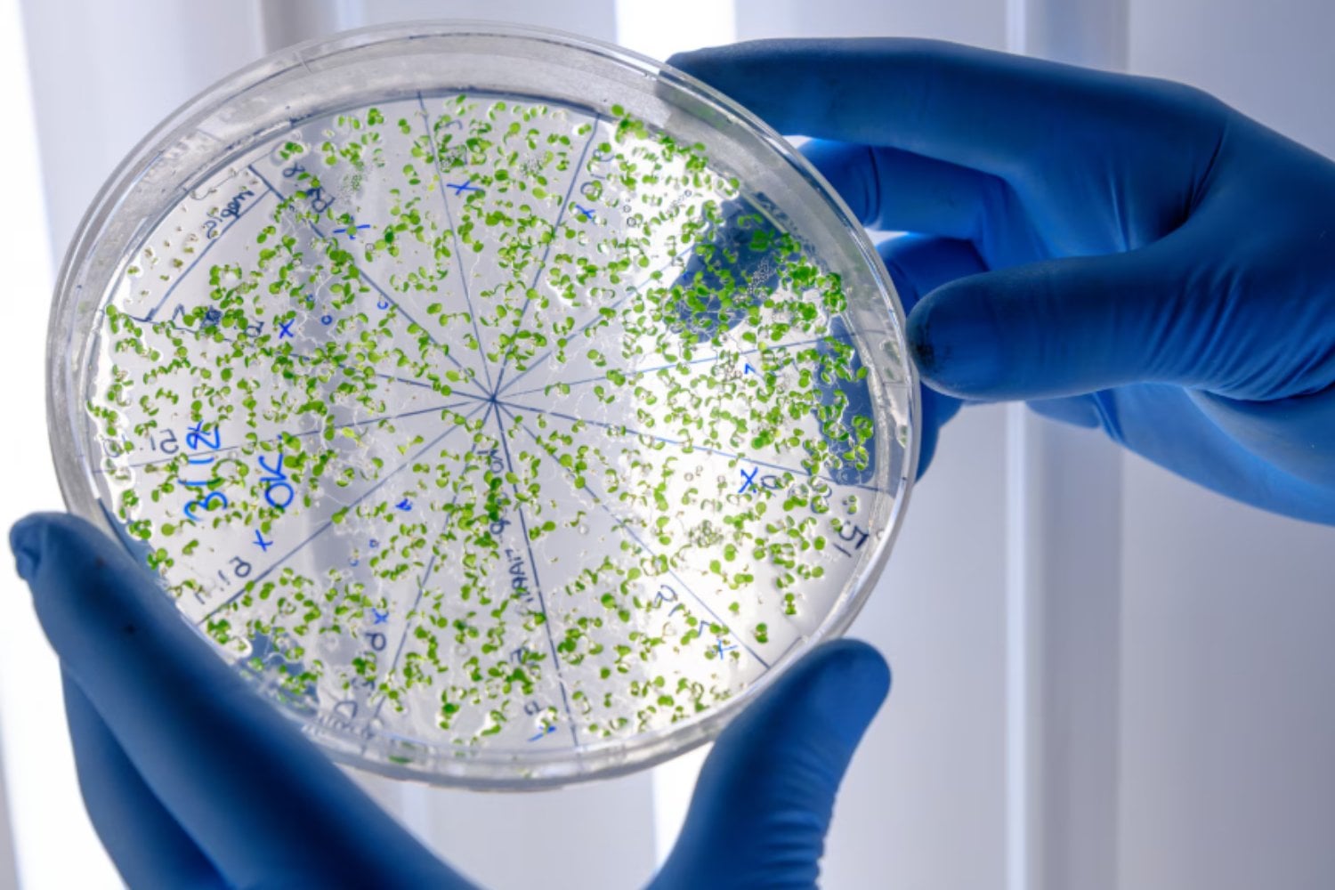 La fototerapia abre una nueva vía contra las superbacterias: un tratamiento que puede devolver la eficacia a los antibióticos