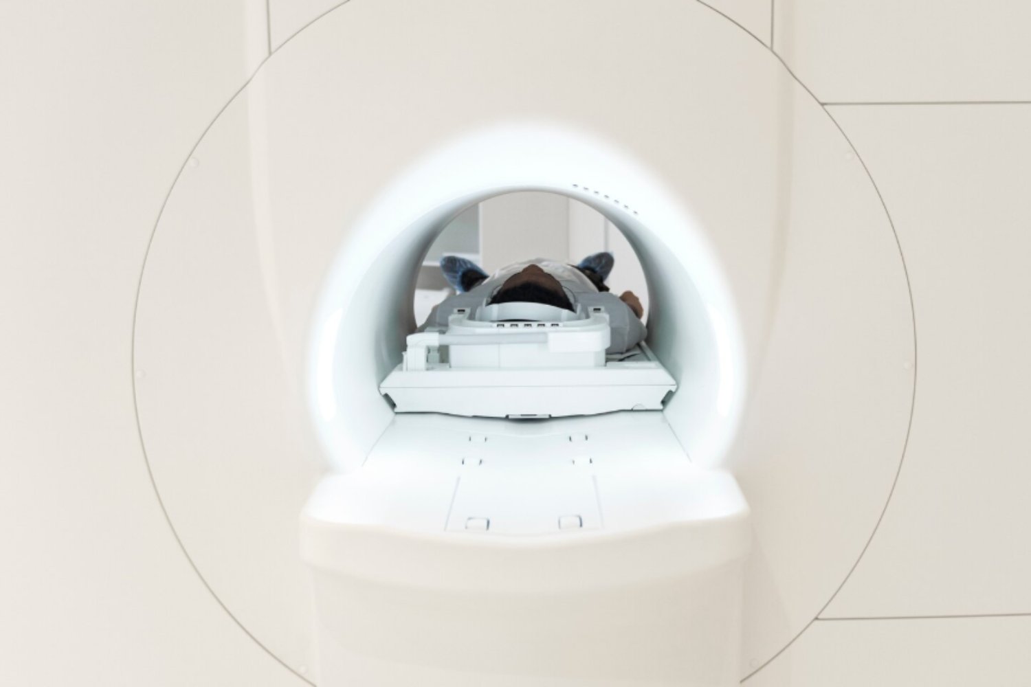 Resonancias de cuerpo entero: ¿chequeo milagroso o fábrica de sustos médicos?