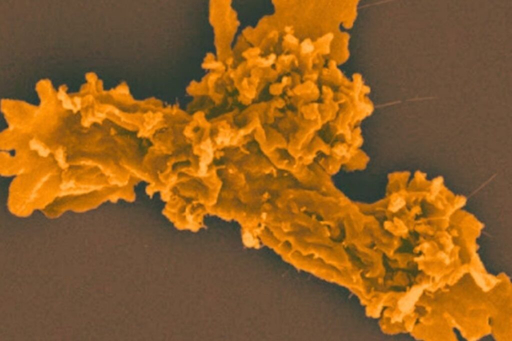 La ameba extrema que redefine los límites de la vida: un microorganismo prospera a 63°C y desafía todo lo que creíamos posible