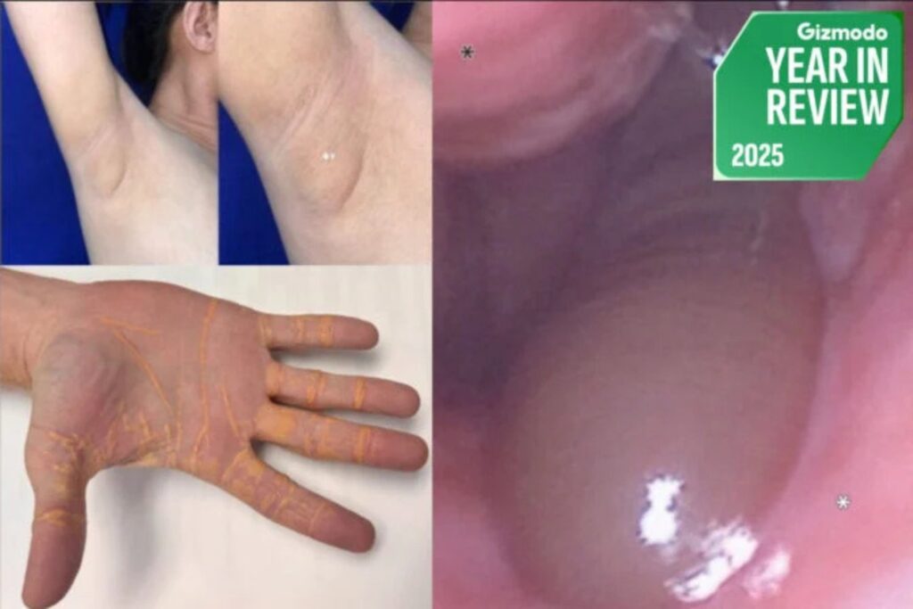 Casos Medicos Extraños