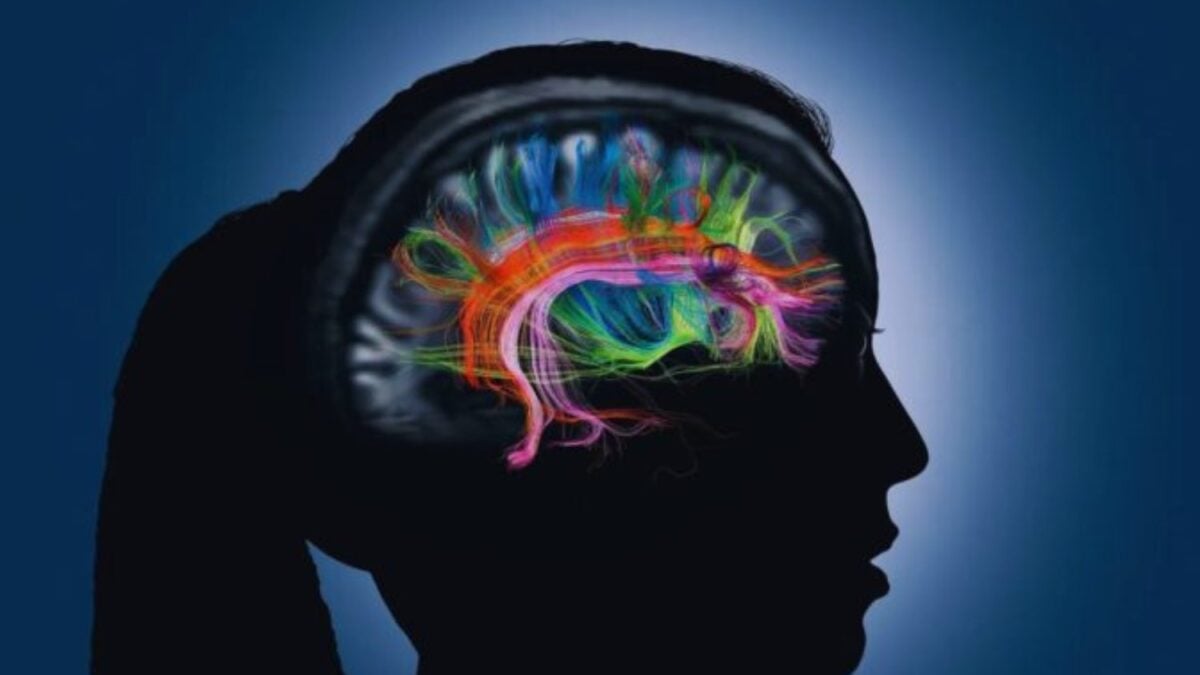Cómo el cerebro combina pensamiento libre y control para dar forma a la creatividad humana
