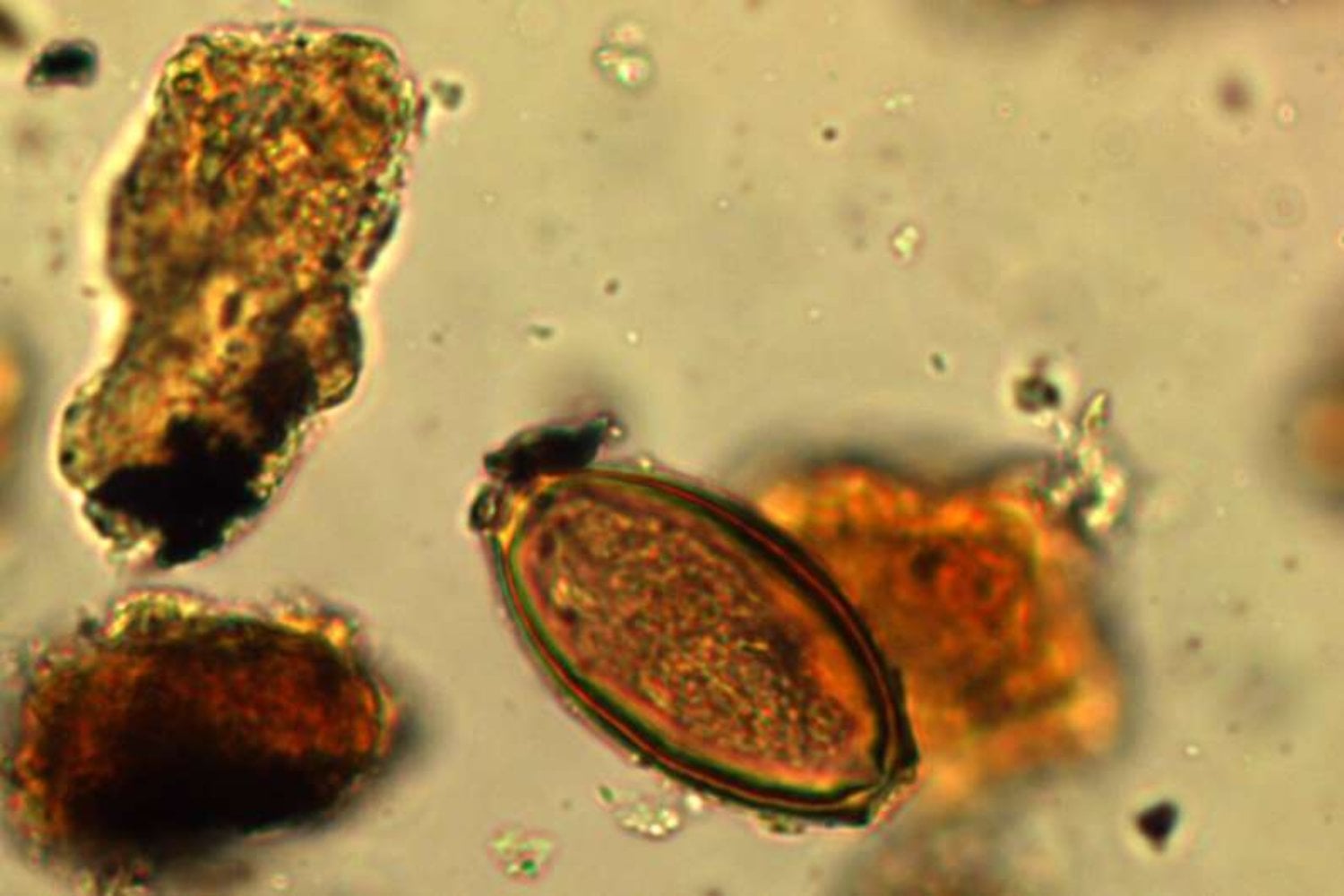 La erupción del Vesubio detuvo el tiempo en Herculano. Pero los parásitos que llevaban los romanos siguieron allí, esperando dos mil años para contarlo