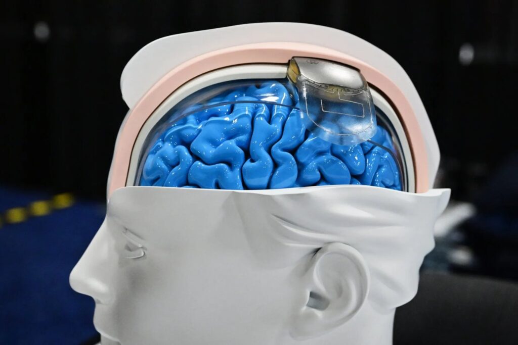 Elon Musk quiere llevar los chips cerebrales a escala industrial. Neuralink apunta a 2026 para producirlos en masa y automatizar la cirugía