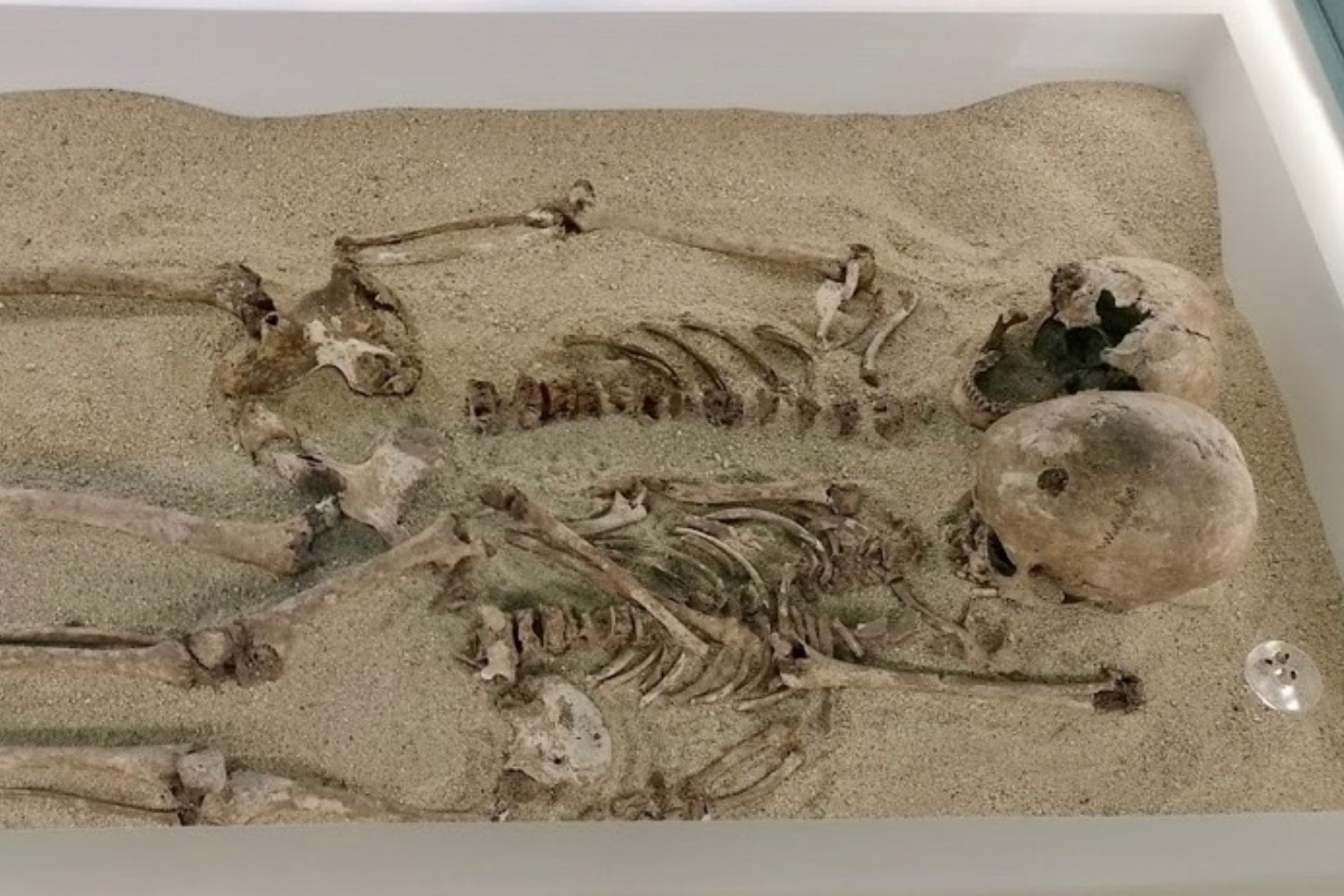 Vivieron hace más de 12.000 años y fueron enterradas juntas. Su ADN acaba de revelar la enfermedad genética más antigua conocida