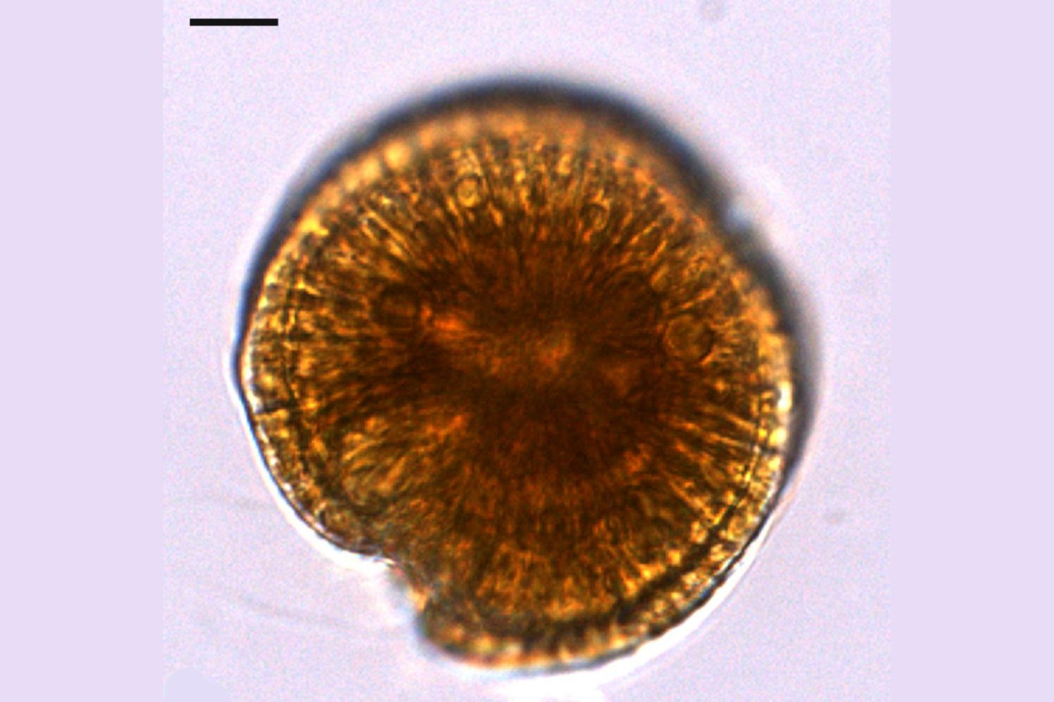 Detectan por primera vez una microalga tóxica en peces del Mediterráneo español. El hallazgo que confirma cambios silenciosos en el mar