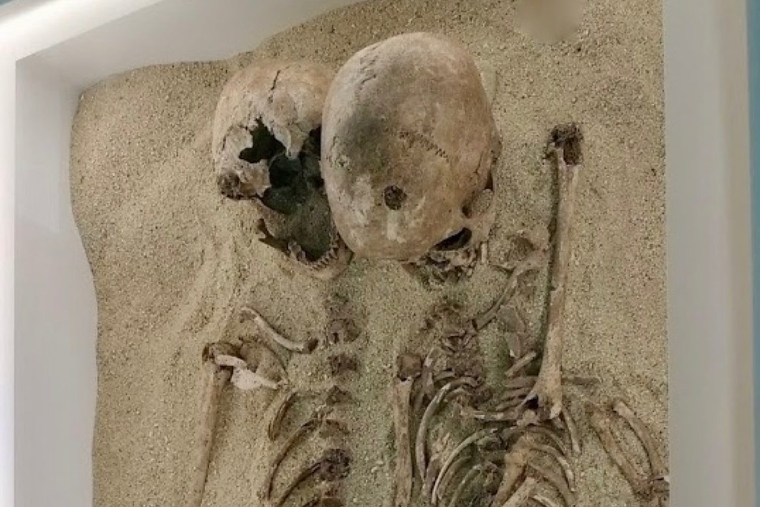 Vivieron hace más de 12.000 años y fueron enterradas juntas. Su ADN acaba de revelar la enfermedad genética más antigua conocida