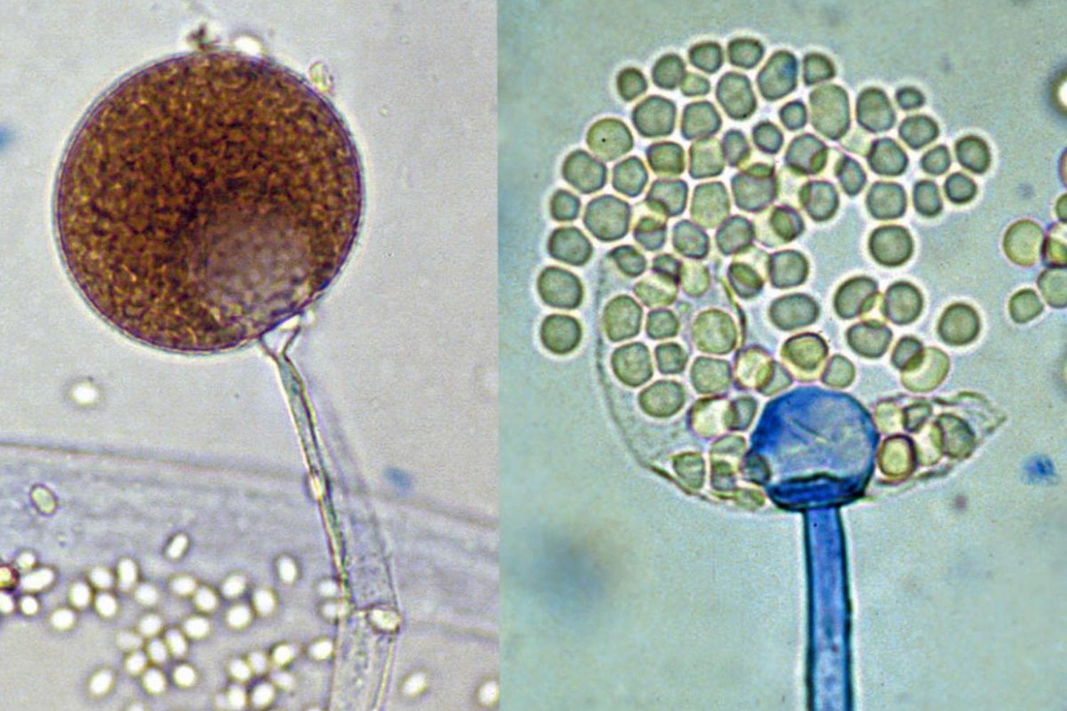 Descubren el mecanismo genético que permite a los hongos transformarse en patógenos humanos. Dos genes actúan como interruptores que reprograman su identidad y activan la infección