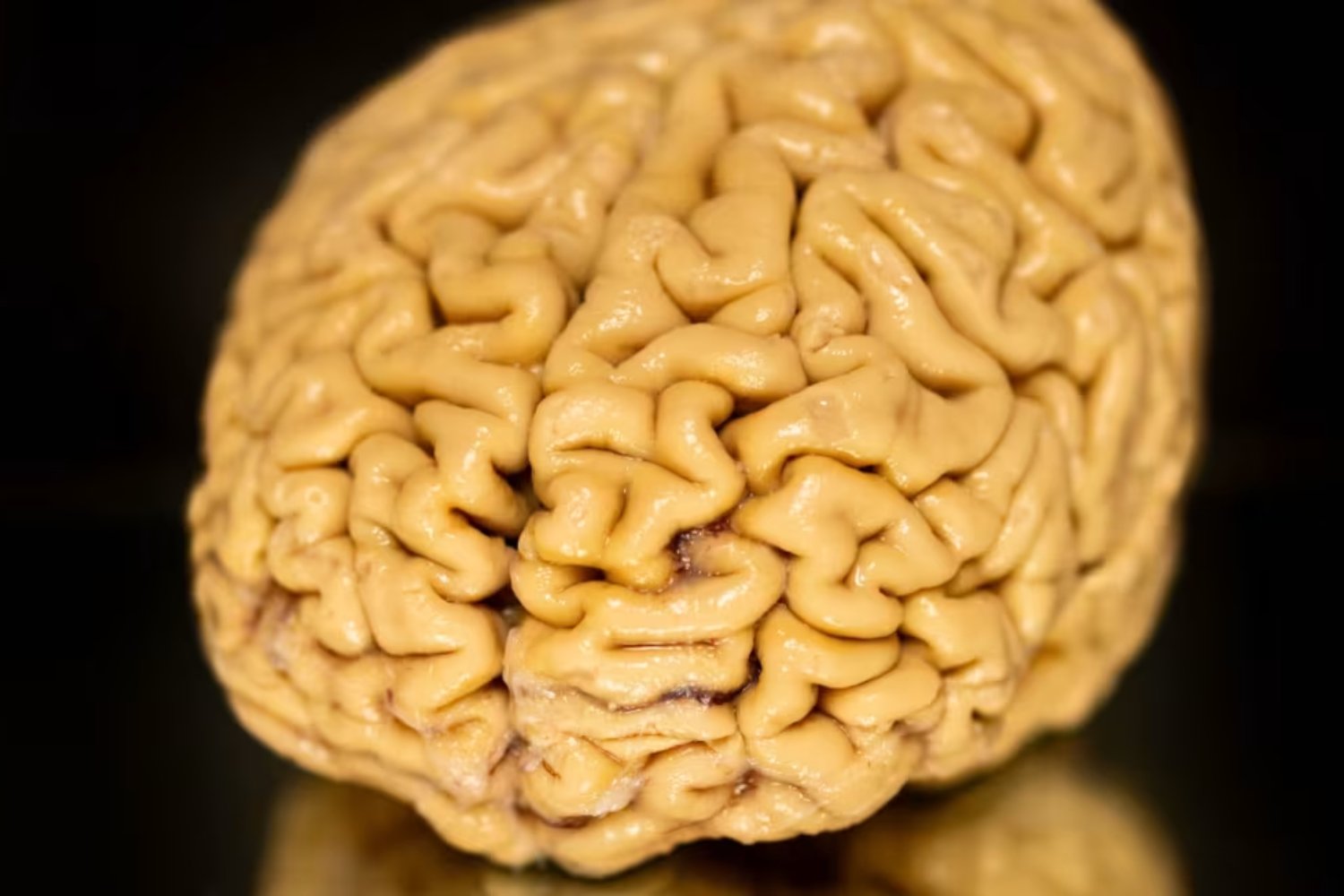 El secreto de la eterna juventud mental no está en la genética sino en la plasticidad cerebral. Los “SuperAgers” duplican la producción de neuronas jóvenes