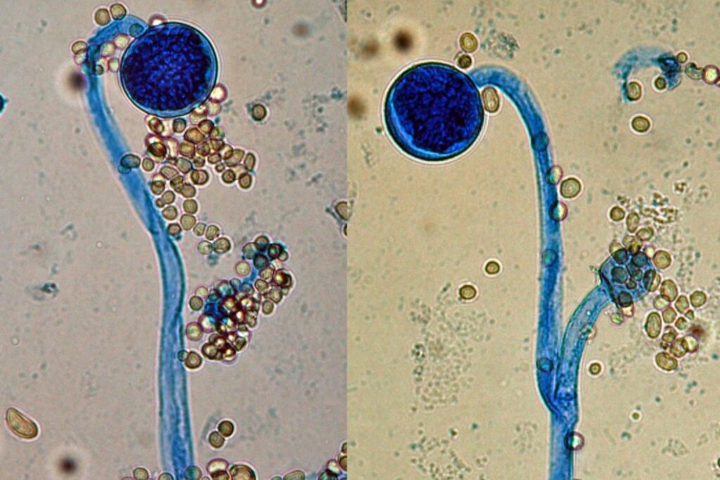 Descubren el mecanismo genético que permite a los hongos transformarse en patógenos humanos. Dos genes actúan como interruptores que reprograman su identidad y activan la infección