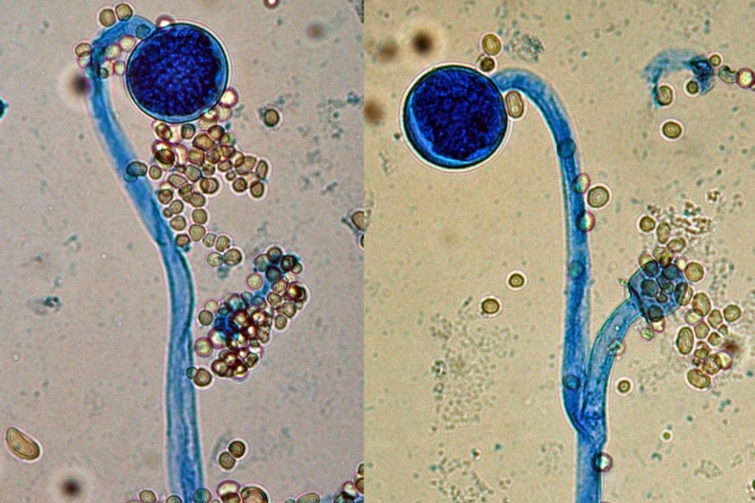 Descubren el mecanismo genético que permite a los hongos transformarse en patógenos humanos. Dos genes actúan como interruptores que reprograman su identidad y activan la infección