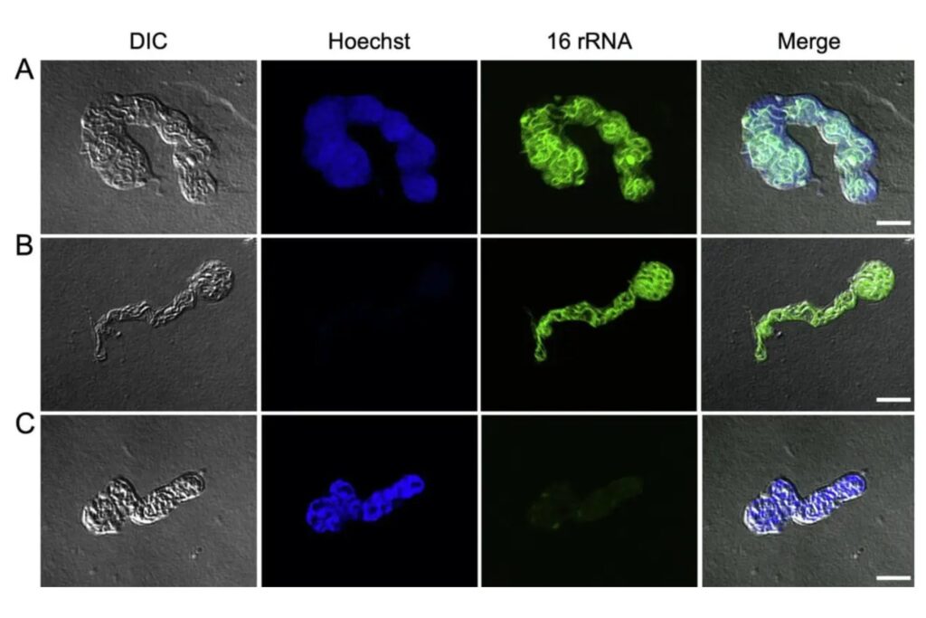 Una bacteria dentro de un insecto acaba de romper una regla básica de la biología celular. Su estructura interna no debería existir (y, sin embargo, está ahí)