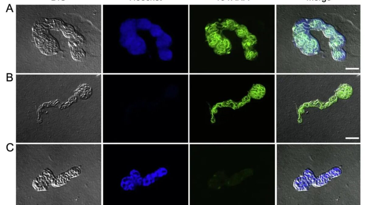 Una bacteria dentro de un insecto acaba de romper una regla básica de la biología celular. Su estructura interna no debería existir (y, sin embargo, está ahí)