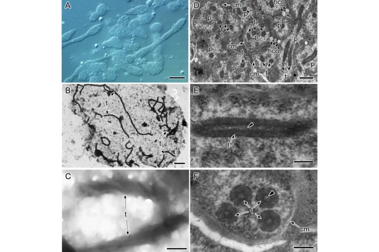 Una bacteria dentro de un insecto acaba de romper una regla básica de la biología celular. Su estructura interna no debería existir (y, sin embargo, está ahí)