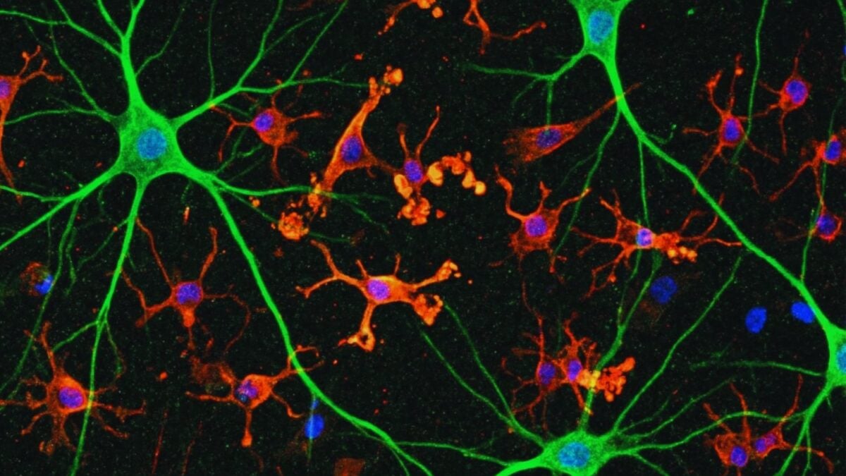 Durante décadas buscamos el origen del Alzheimer en los lugares equivocados. Una batalla microscópica dentro de las neuronas podría cambiar lo que sabemos sobre la enfermedad