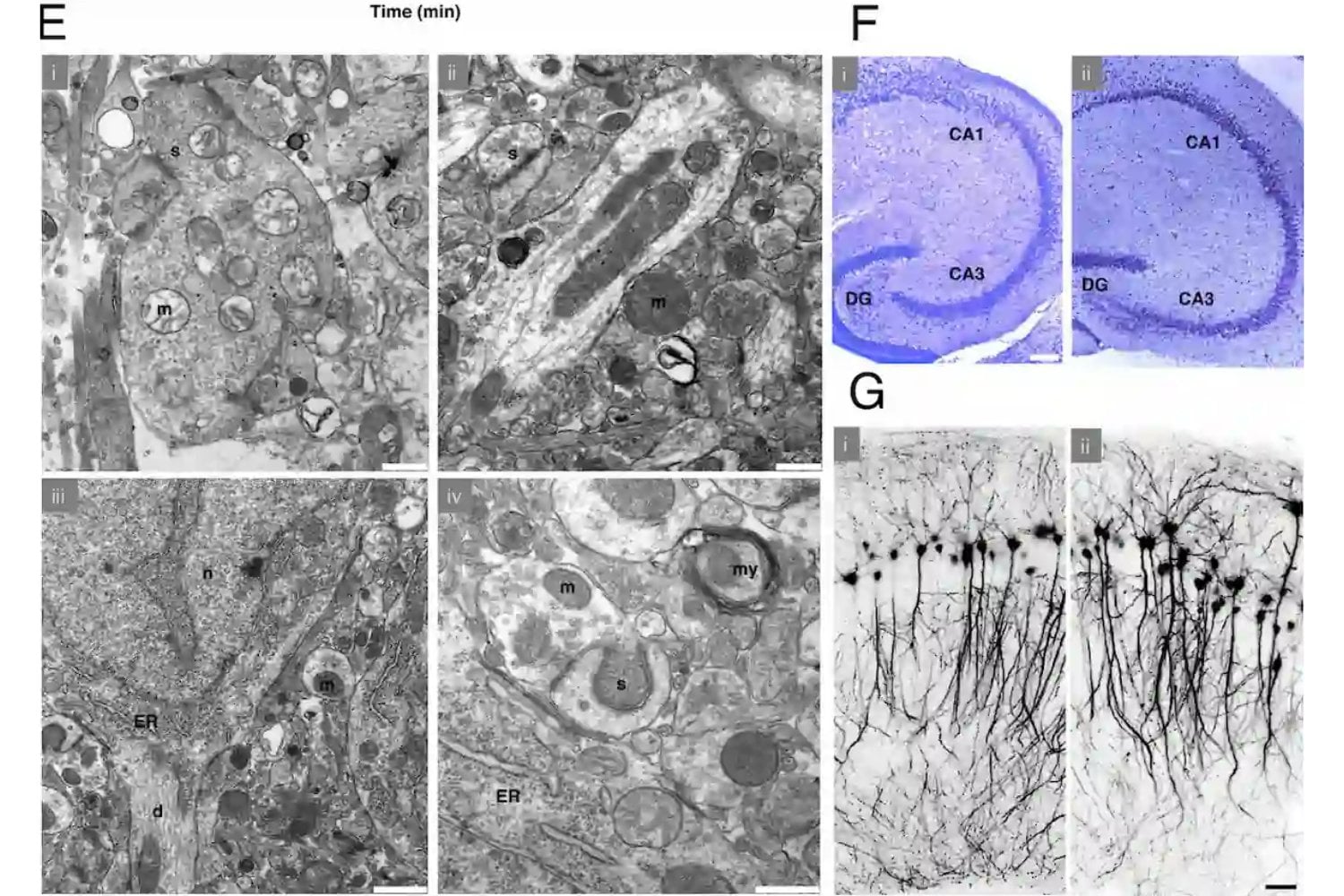 Lo que parecía ciencia ficción acaba de dar un paso incómodo hacia la realidad. Un equipo alemán logró que tejido cerebral de ratón recuperara actividad funcional tras haber sido vitrificado a -196 °C