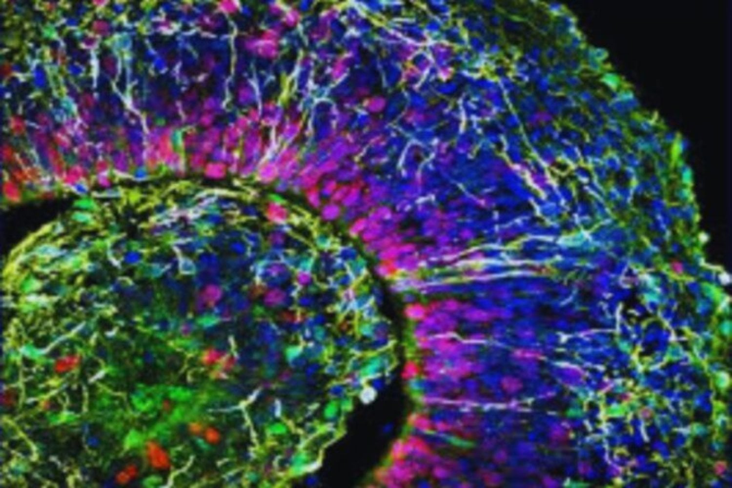 El Alzheimer podría no empezar donde creíamos y eso cambia todo lo que sabemos sobre la enfermedad. Un nuevo estudio revela que una “competencia” microscópica entre proteínas dentro de las neuronas podría ser el verdadero origen del deterioro cognitivo