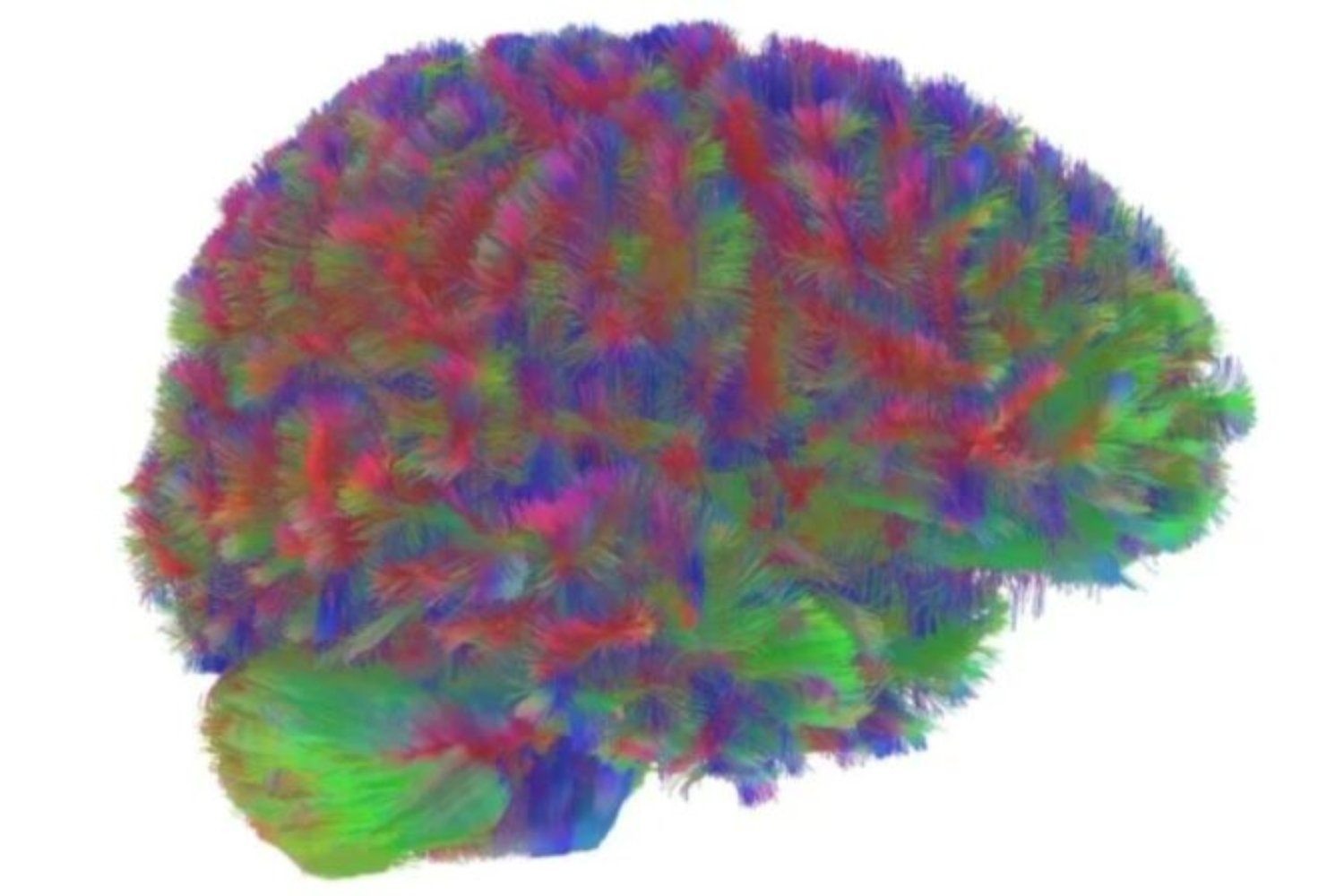 El Alzheimer podría no empezar donde creíamos y eso cambia todo lo que sabemos sobre la enfermedad. Un nuevo estudio revela que una “competencia” microscópica entre proteínas dentro de las neuronas podría ser el verdadero origen del deterioro cognitivo