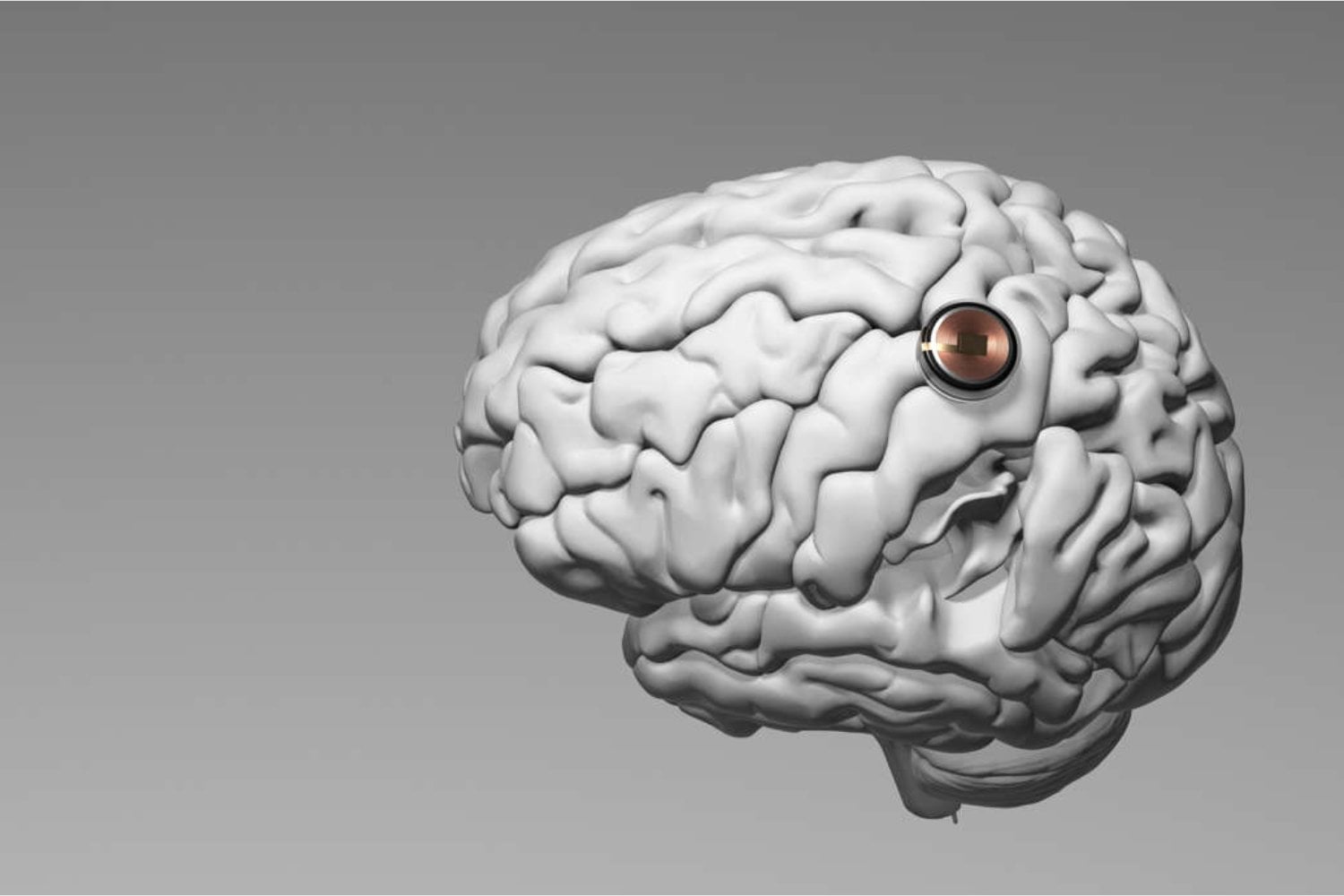 China no quiere quedarse fuera de la tecnología más inquietante del futuro. Mientras todos miran la inteligencia artificial, ya está acelerando con implantes cerebrales propios