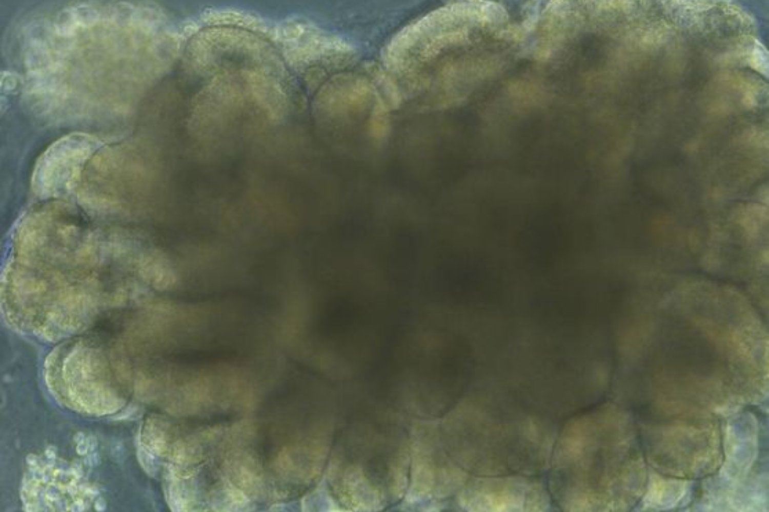 Desafían a un ‘minicerebro’ cultivado en laboratorio a resolver el problema del péndulo invertido. Lo que ocurre sugiere que la inteligencia no es solo cuestión de algoritmos