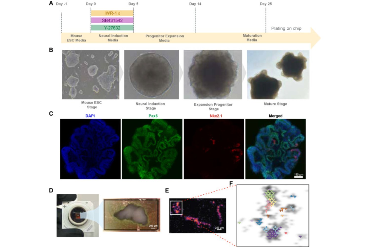 Desafían a un ‘minicerebro’ cultivado en laboratorio a resolver el problema del péndulo invertido. Lo que ocurre sugiere que la inteligencia no es solo cuestión de algoritmos