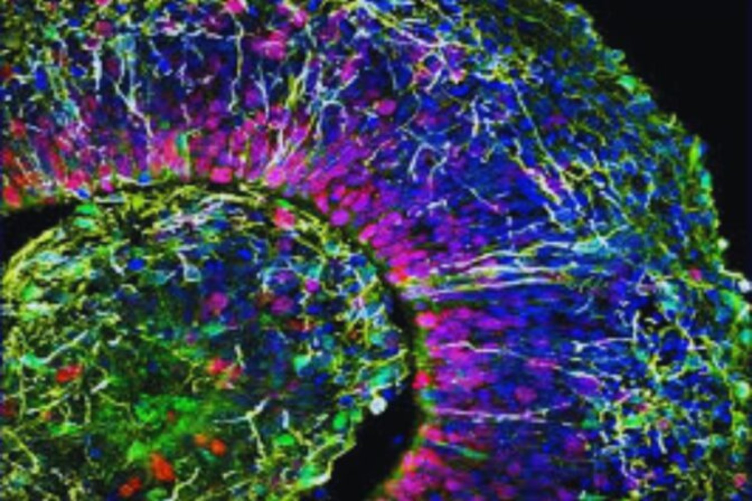 Desafían a un ‘minicerebro’ cultivado en laboratorio a resolver el problema del péndulo invertido. Lo que ocurre sugiere que la inteligencia no es solo cuestión de algoritmos