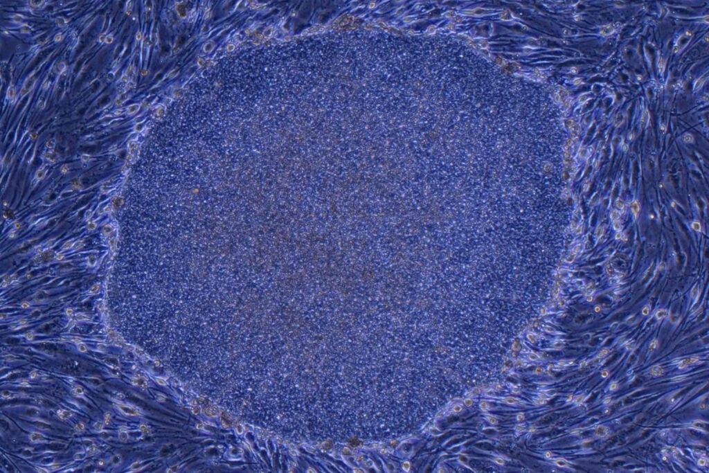 Japón convierte una promesa científica en medicina real. Aprueba los primeros tratamientos del mundo creados con células humanas reprogramadas