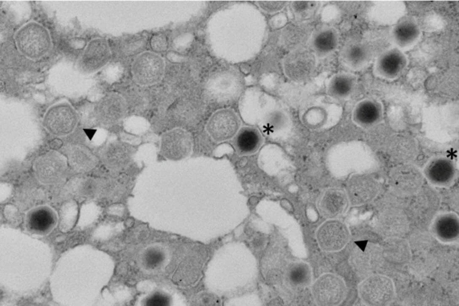 Un virus gigante escondido en un pantano de Japón está obligando a replantear el papel de los virus en la evolución. Podría ser una pieza clave en el origen de la vida compleja