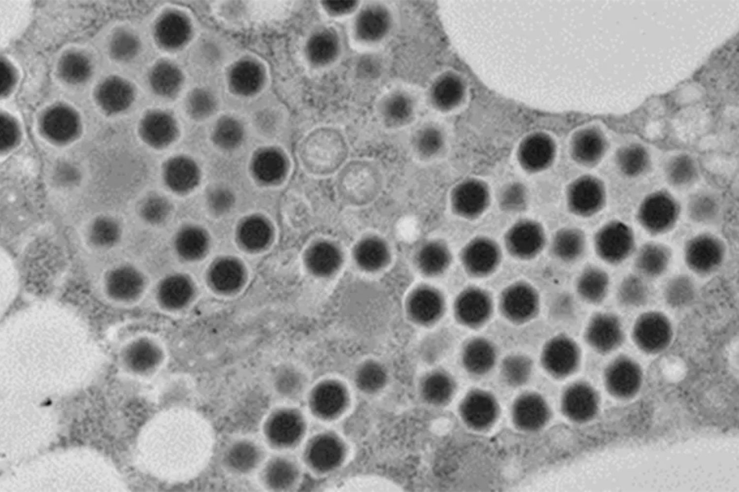 Un virus gigante escondido en un pantano de Japón está obligando a replantear el papel de los virus en la evolución. Podría ser una pieza clave en el origen de la vida compleja