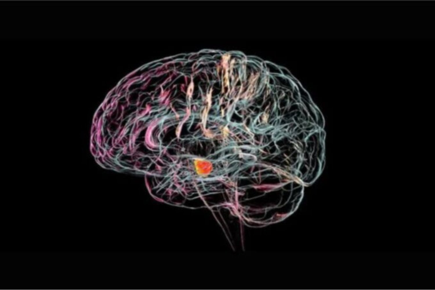 China acaba de autorizar su primer chip cerebral comercial y la noticia va mucho más allá de un avance médico. Detrás del implante hay una estrategia estatal para convertir las interfaces cerebro-computadora en una industria clave antes que Occidente llegue al mercado