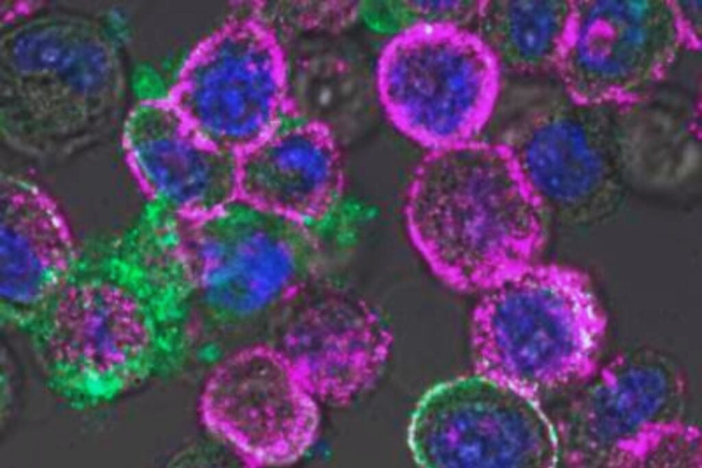 Un virus diseñado en Argentina para “cazar” tumores acaba de ser adquirido por una empresa del Nasdaq tras dos décadas de desarrollo. La historia muestra cómo la ciencia básica puede convertirse en una terapia contra el cáncer