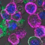 Un virus diseñado en Argentina para “cazar” tumores acaba de ser adquirido por una empresa del Nasdaq tras dos décadas de desarrollo. La historia muestra cómo la ciencia básica puede convertirse en una terapia contra el cáncer