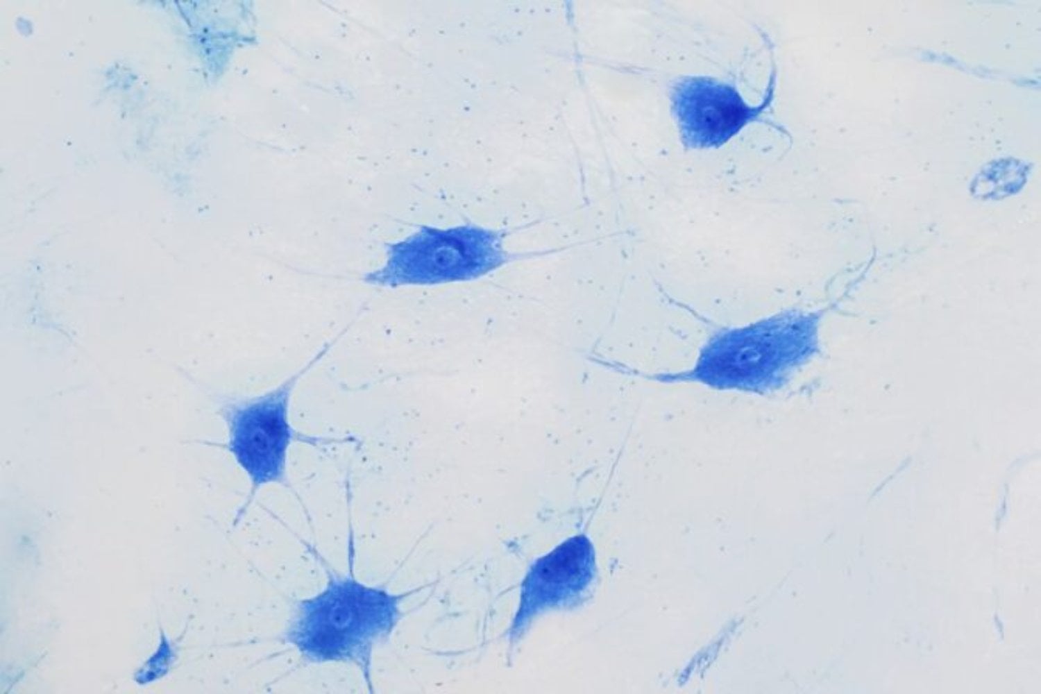 La historia de cómo nació la vida compleja en la Tierra tenía una grieta que no terminaba de cerrar. Ahora un análisis masivo de ADN sugiere que nuestros ancestros microbianos ya habían aprendido a usar oxígeno antes de dar el salto evolutivo decisivo