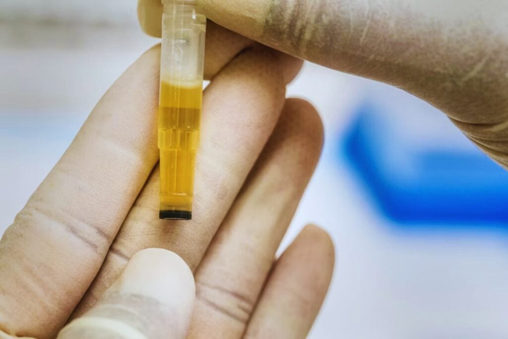 Científicos británicos convierten orina humana en fertilizante con muy poca energía. El avance no solo recicla residuos: también cuestiona cómo alimentamos al planeta