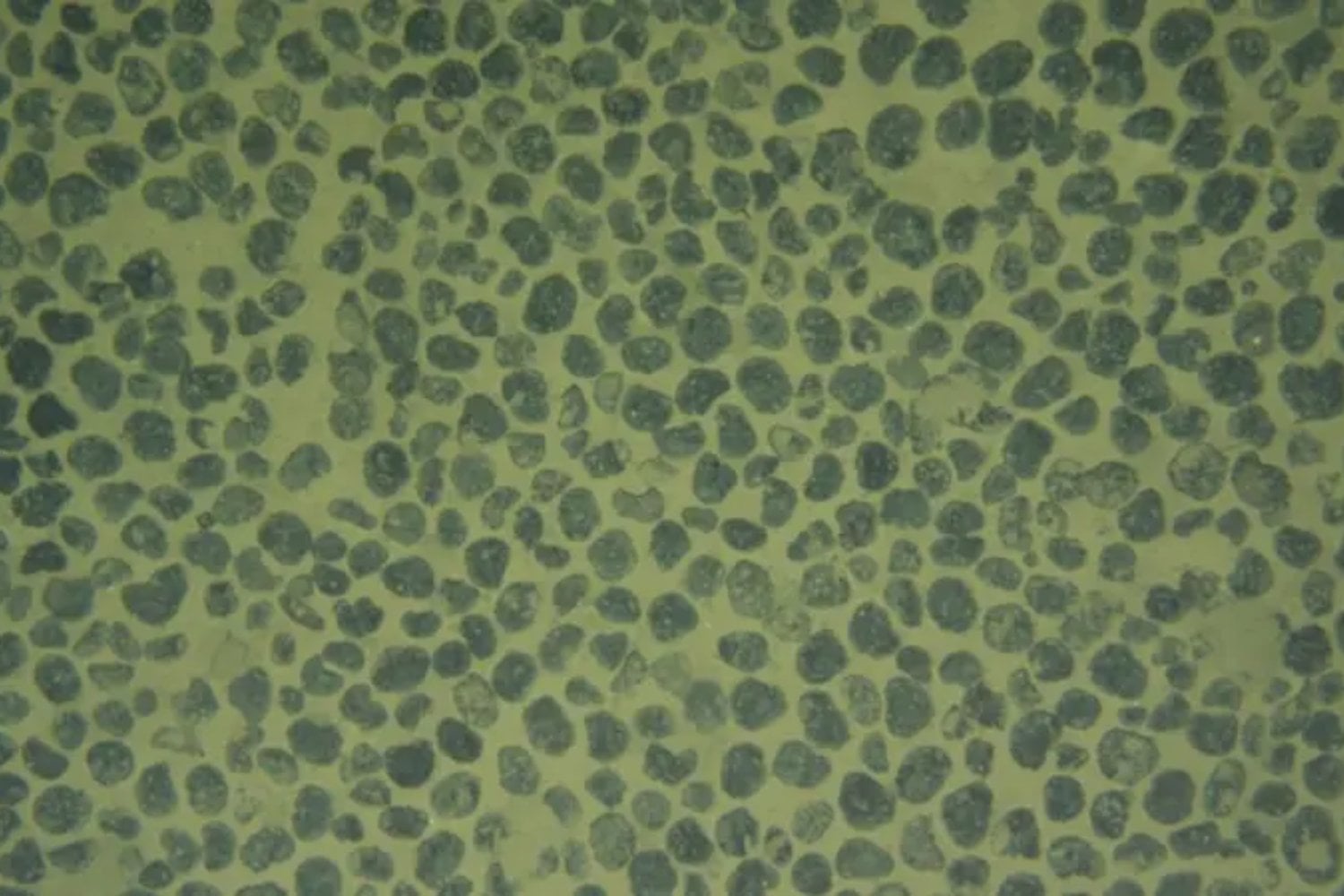 Descubren 24 especies nuevas a 4.000 metros de profundidad en el océano Pacífico. Una de ellas es tan extraña que obligó a crear una nueva superfamilia