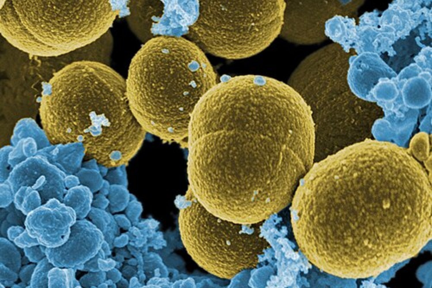 Encontrar nuevos antibióticos se ha vuelto cada vez más difícil y lento. Un sistema de inteligencia artificial acaba de cambiar ese proceso diseñando moléculas desde cero para combatir superbacterias resistentes