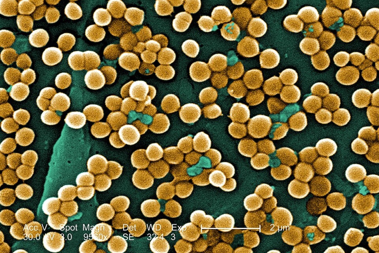 Encontrar nuevos antibióticos se ha vuelto cada vez más difícil y lento. Un sistema de inteligencia artificial acaba de cambiar ese proceso diseñando moléculas desde cero para combatir superbacterias resistentes