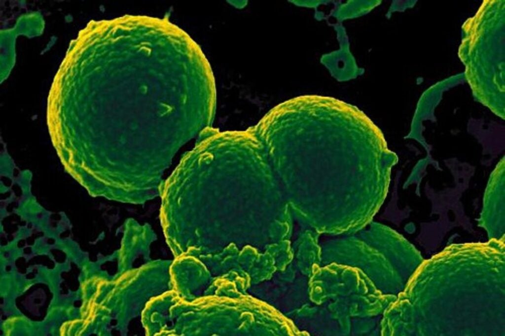 Encontrar nuevos antibióticos se ha vuelto cada vez más difícil y lento. Un sistema de inteligencia artificial acaba de cambiar ese proceso diseñando moléculas desde cero para combatir superbacterias resistentes