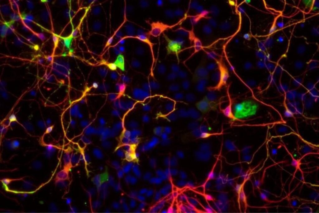 Científicos descubrieron células inmunológicas capaces de “recordar” tumores y producir anticuerpos dirigidos contra el cáncer durante años. El hallazgo podría cambiar el futuro de las vacunas anticancerígenas