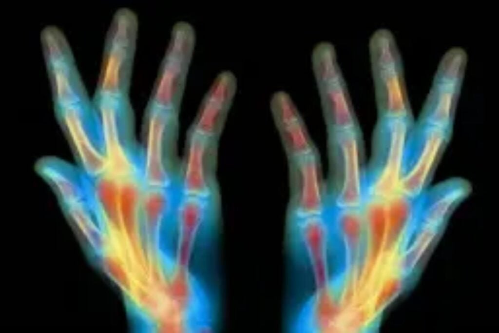 Los científicos creen haber encontrado una pista clave para algo que parecía imposible en humanos. Un nuevo experimento logró regenerar huesos, tendones y ligamentos activando mecanismos ocultos de curación