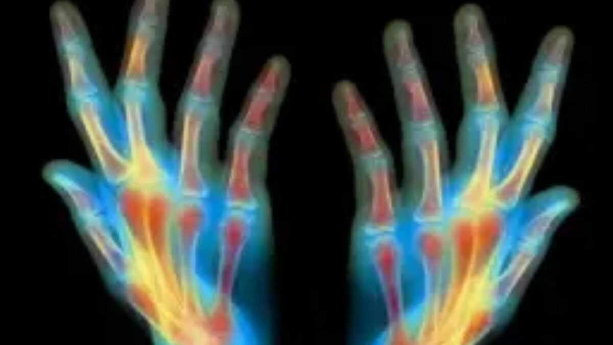 Los científicos creen haber encontrado una pista clave para algo que parecía imposible en humanos. Un nuevo experimento logró regenerar huesos, tendones y ligamentos activando mecanismos ocultos de curación