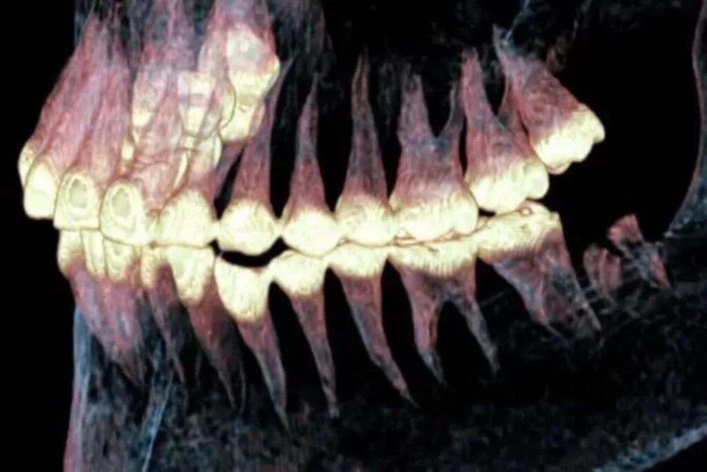 Arqueólogos encontraron 13 dientes fósiles que no pertenecen a ninguna especie humana conocida. El hallazgo podría revelar la existencia de un ancestro perdido que convivió con otros linajes hace más de dos millones de años