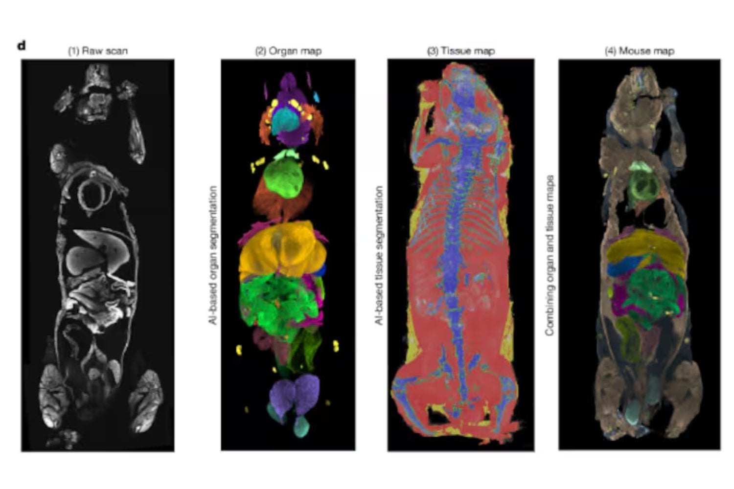 La medicina acaba de dar un paso hacia una especie de “Google Maps” microscópico del cuerpo humano. Una IA permite recorrer enfermedades completas desde el nivel de órganos hasta células individuales