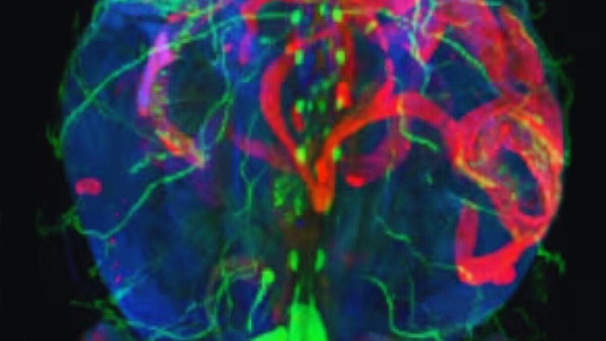 La medicina acaba de dar un paso hacia una especie de “Google Maps” microscópico del cuerpo humano. Una IA permite recorrer enfermedades completas desde el nivel de órganos hasta células individuales