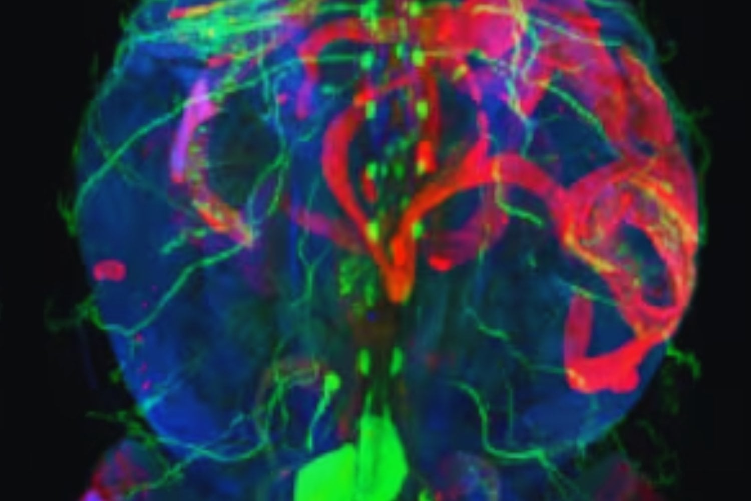 La medicina acaba de dar un paso hacia una especie de “Google Maps” microscópico del cuerpo humano. Una IA permite recorrer enfermedades completas desde el nivel de órganos hasta células individuales