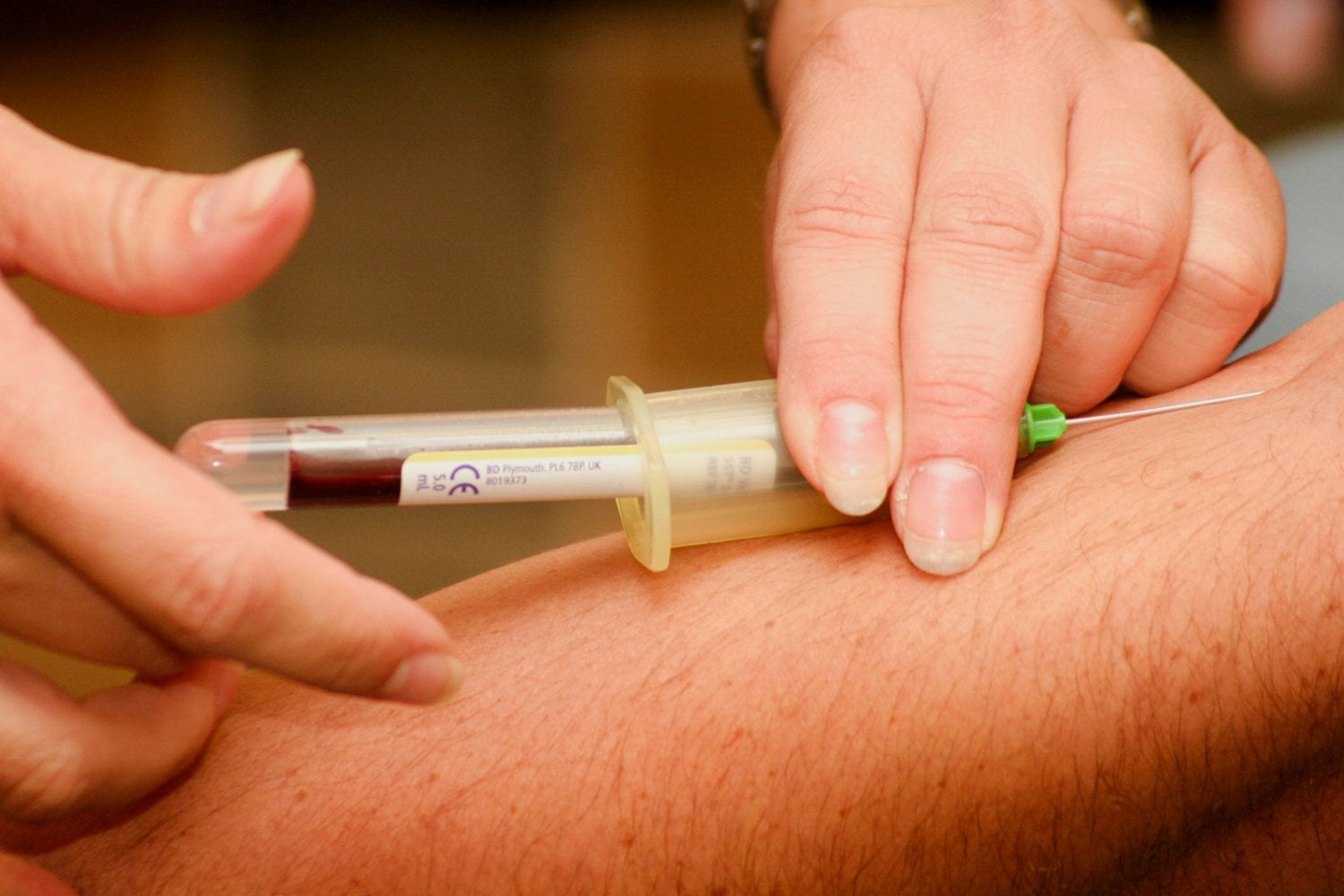 Analisis De Sangre